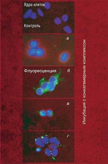 Процесс проникновения в клетки-мишени различных конкатемерных комплексов, несущих одинаковый терапевтический олигонуклеотид, можно визуально отследить благодаря флуоресцентной метке, входящей в его состав (зеленое свечение). Видно, что наличие липофильных холестериновых групп в составе комплеска способствует его транспорту в клетки: а – инкубация с немодифицированным конкатемерным комплексом; б – инкубация с холестерин-модифицированным конкатемерным комплексом в течение 3 часов: комплесы накапливаются в цитоплазме клеток; в – инкубация с холестерин-модифицированным конкатемерным комплексом в течение 17 часов: терапевтический олигонуклеотид проник из цитоплазмы в ядра клеток; г – инкубация с конкатемерным комплексом, несущим только один остаток холестерина. Фотографии микропрепаратов ядер клеток линии 293, окрашеных Hoechst33258 (синее свечение), совмещены с фотографиями распределения конкатемерных комплексов, полученными с помощью флуоресцентной микроскопии (зеленое свечение). Фото О. Гусаченко (ИХБФМ СО РАН)