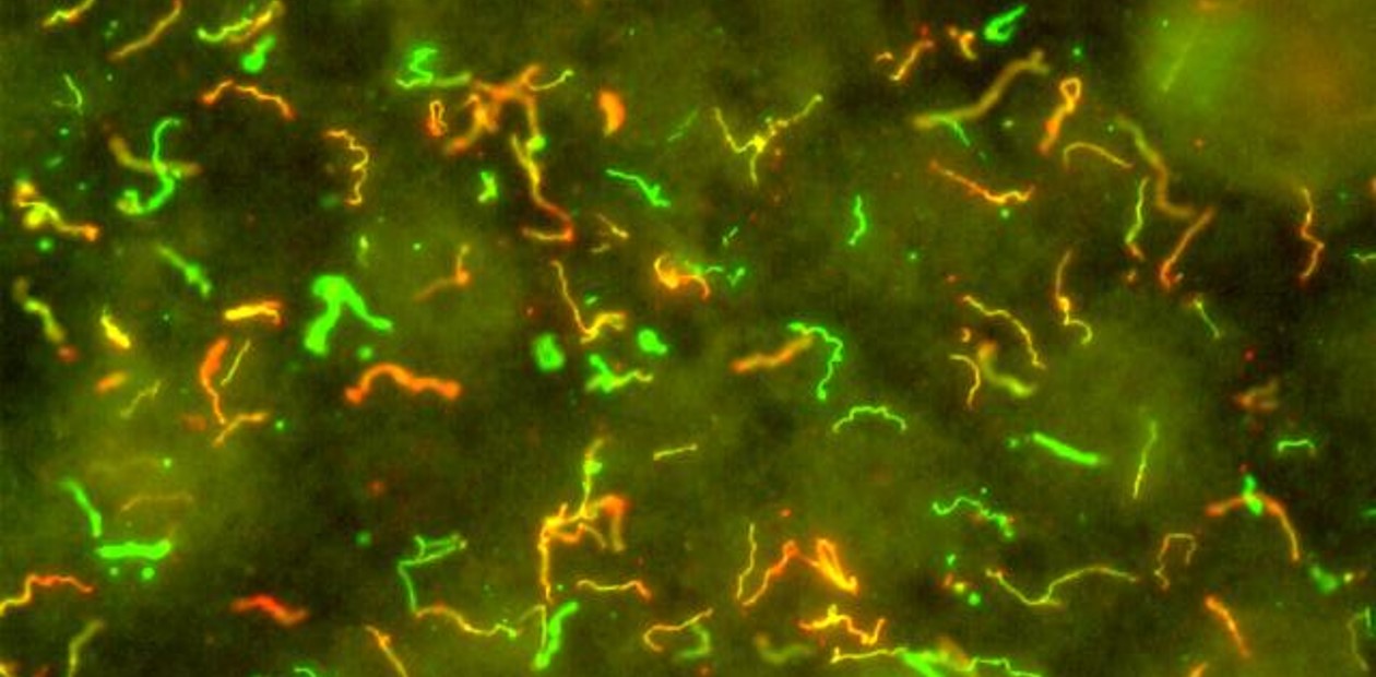 Спирохеты Borrelia burgdorferi. Окраска с помощью иммунофлуоресцентных антител Спирохеты Borrelia burgdorferi. Окраска с помощью иммунофлуоресцентных антител