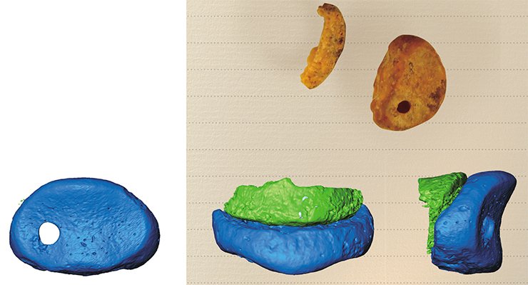Computer tomography of the finger phalanx that belonged to the Paleolithic man from Denisova Cave: the proximal, dorsal, and lateral projections, respectively Computer tomography of the finger phalanx that belonged to the Paleolithic man from Denisova Cave: the proximal, dorsal, and lateral projections, respectively