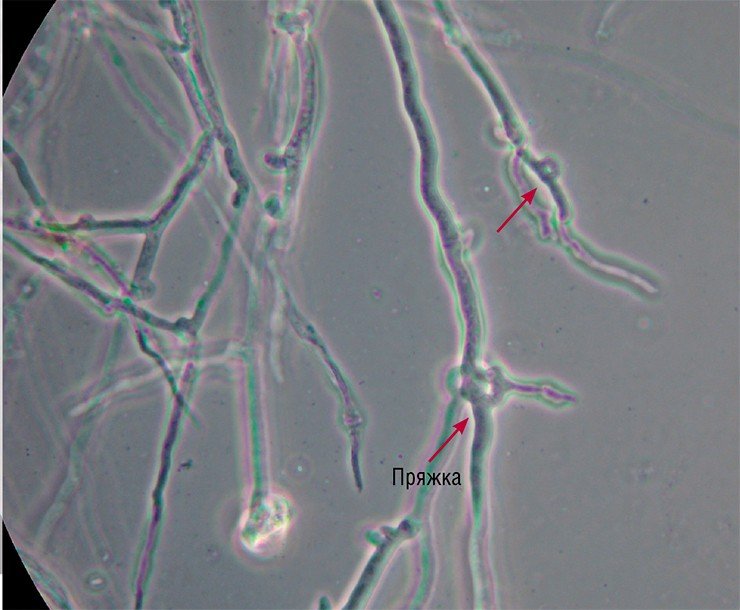 Мицелий вешенки легочной (Pleurotus pulmonarius). Вешенки, или устричные грибы, обычно произрастают в лесах умеренной зоны на валежнике, пнях, ослабленных деревьях преимущественно лиственных пород. Эти вкусные и полезные грибы культивируют на самых разных субстратах. 