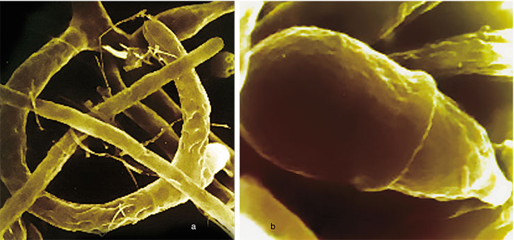 Trap (a) and conidia, the reproduction organ, (b) of the predatory fungi of the species Arthrobotrys oligospora. The author of the strain is T. Tepliakova. Electronic microscope Trap (a) and conidia, the reproduction organ, (b) of the predatory fungi of the species Arthrobotrys oligospora. The author of the strain is T. Tepliakova. Electronic microscope
