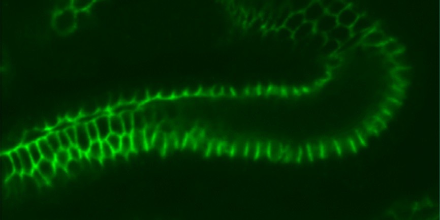 Белок клаудин в кишечном эпителии эмбриона плодовой мушки Drosophila melanogaster, окрашенный специфичными флуоресцирующими антителами. © CC BY-SA 2.5/ Nina Белок клаудин в кишечном эпителии эмбриона плодовой мушки Drosophila melanogaster, окрашенный специфичными флуоресцирующими антителами. © CC BY-SA 2.5/ Nina