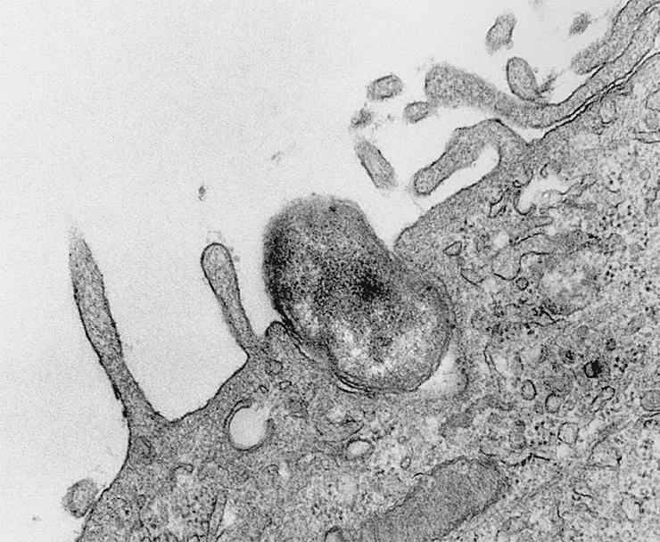 The genus Rickettsia belongs to the family Rickettsiaceae, which also includes the genus Orientia. The bacterium Orientia tsutsugamushi is the causative agent of Tsutsugamushi fever (Japanese river fever), which follows a scenario typical of all rickettsioses: fever, skin rashes, etc. It is carried by the larvae of red velvet mites. Right: O. tsutsugamushi bacterial cell ingested by a peritoneal mesothelial cell of a mouse. Transmission electron microscopy. Photo 1976. © CDC