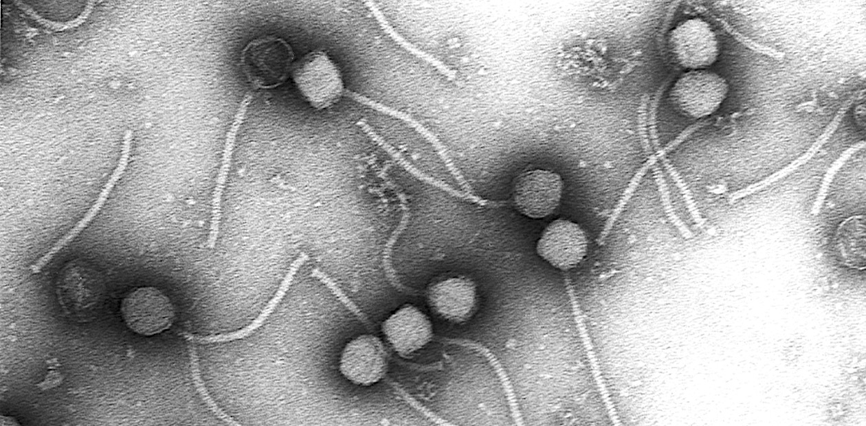 Вирусные частицы бактериофага Gamma, специфически поражающего возбудителя сибирской язвы Bacillus anthracis. Фаг был выделен из природного источника и сохранен для исследований французским микробиологом Ф. д’Эрелем. Просвечивающая электронная микроскопия. © CC BY 2.5/Photograph courtesy of Vincent Fischetti and Raymond Schuch, The Rockefeller University