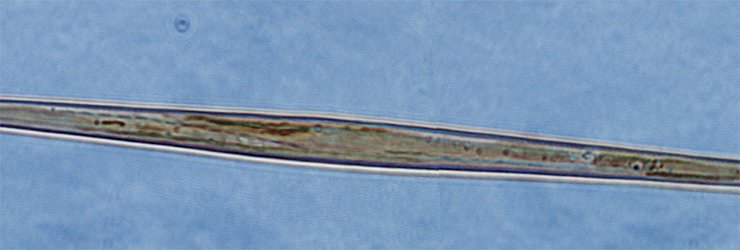 Synedra acus diatom. Light microscopy Synedra acus diatom. Light microscopy