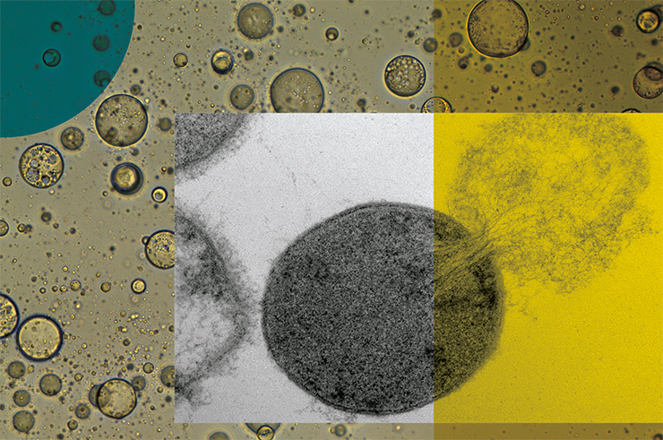The osmotic pressure caused by the stop of energy-dependent sodium-potassium pumps ruptures the cell membrane, releasing cellular metabolites into intercellular substance, such as the serum. The photo shows a Streptococcus pyogenes cell subjected to lysis under the influence of the PlyC enzyme. Credit: Daniel Nelson, UMD The osmotic pressure caused by the stop of energy-dependent sodium-potassium pumps ruptures the cell membrane, releasing cellular metabolites into intercellular substance, such as the serum. The photo shows a Streptococcus pyogenes cell subjected to lysis under the influence of the PlyC enzyme. Credit: Daniel Nelson, UMD