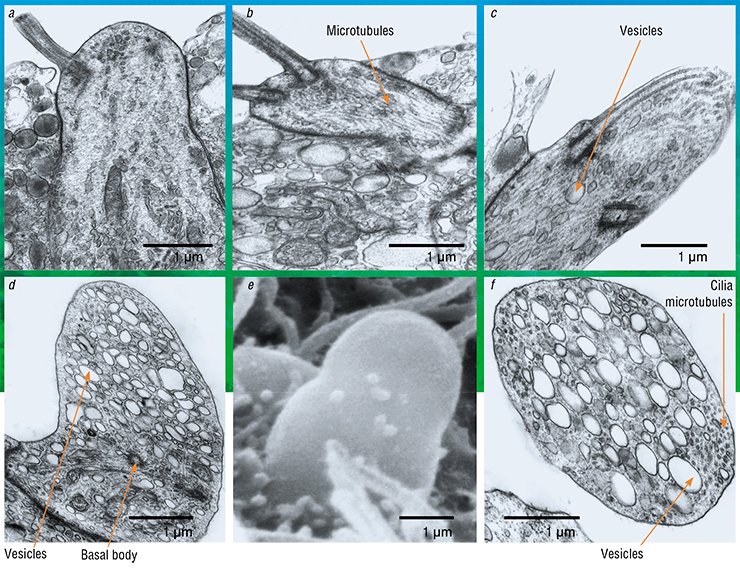 Ultrastructural reorganizations at the tops of receptor cells in yellowfin sculpins in different phases of their life cycle and reproductive behavior: a – inter-spawn period; the cell functions as an ordinary chemoreceptor cell perceiving food signals; b – spawning; the cell is tuned to the perception of pheromones; an ordered system of microtubules is developed; c – cilium is immersed into the dendrite; d – top of the cell in the dendritic neurosecretion phase. The basal body, i. e. the structure from which the cilium extends; here it is covered with a large number of secretory vesicles; e – this is how the top of the cell without flagella looks like; f – disaggregation of the microtubules immersed inside the cell during its dying after an active secretory process. Electron microscopy Ultrastructural reorganizations at the tops of receptor cells in yellowfin sculpins in different phases of their life cycle and reproductive behavior: a – inter-spawn period; the cell functions as an ordinary chemoreceptor cell perceiving food signals; b – spawning; the cell is tuned to the perception of pheromones; an ordered system of microtubules is developed; c – cilium is immersed into the dendrite; d – top of the cell in the dendritic neurosecretion phase. The basal body, i. e. the structure from which the cilium extends; here it is covered with a large number of secretory vesicles; e – this is how the top of the cell without flagella looks like; f – disaggregation of the microtubules immersed inside the cell during its dying after an active secretory process. Electron microscopy