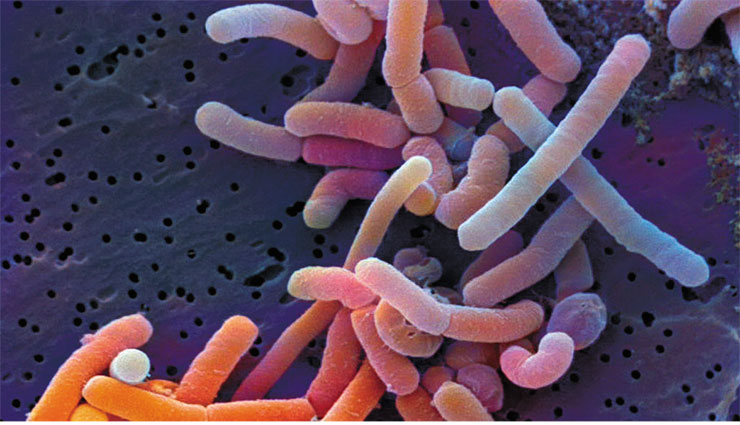 Молочнокислая бактерия Lactobacillus paracasei, способная выживать при высокой кислотности среды, является частью нормальной кишечной микрофлоры, проявляет свойства пробиотика и используется в терапии язвенного колита, дивертикулярной болезни кишечника и синдрома раздраженного кишечника. © CC BY-SA 3.0 de/ Dr. Horst Neve, Max Rubner-Institut Молочнокислая бактерия Lactobacillus paracasei, способная выживать при высокой кислотности среды, является частью нормальной кишечной микрофлоры, проявляет свойства пробиотика и используется в терапии язвенного колита, дивертикулярной болезни кишечника и синдрома раздраженного кишечника. © CC BY-SA 3.0 de/ Dr. Horst Neve, Max Rubner-Institut