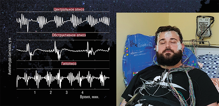 Портативное устройство отечественного производства «БиоРАСКАН» для кардиореспираторного мониторинга позволяет одновременно регистрировать 12-канальную электрокардиограмму, артериальное давление, поток воздуха через нос, степень насыщения крови кислородом и частоту сердечного пульса, движения грудной клетки, а также имеет встроенный акселерометрический датчик. Фото М. Бочкарева Портативное устройство отечественного производства «БиоРАСКАН» для кардиореспираторного мониторинга позволяет одновременно регистрировать 12-канальную электрокардиограмму, артериальное давление, поток воздуха через нос, степень насыщения крови кислородом и частоту сердечного пульса, движения грудной клетки, а также имеет встроенный акселерометрический датчик. Фото М. Бочкарева