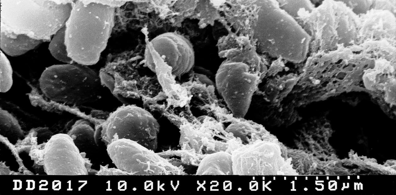 Бактерии Yersinia pestis (возбудитель бубонной чумы) в кишечнике блохи. Сканирующая электронная микроскопия. Credit: NIAID Бактерии Yersinia pestis (возбудитель бубонной чумы) в кишечнике блохи. Сканирующая электронная микроскопия. Credit: NIAID