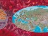 Системному заболеванию - системный подход