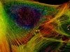Ядовитые наношарики убивают только опухоль и метастазы