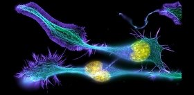 Модифицированный ВИЧ вместо пересадки костного мозга