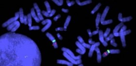 FDA разрешило применение лекарства от врожденных мышечных дистрофий по ускоренной процедуре