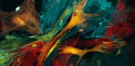 Блокатор рецептора жирных кислот дает бой метастазам
