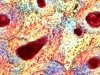 В костной ткани образуется пока еще неизвестный гормон, влияющий на аппетит В костной ткани образуется пока еще неизвестный гормон, влияющий на аппетит