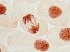 Альтернатива пересадке сердца: ученые заставили делиться зрелые клетки сердечной мышцы Альтернатива пересадке сердца: ученые заставили делиться зрелые клетки сердечной мышцы