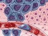 Магнитная ловушка для раковых клеток Магнитная ловушка для раковых клеток