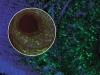 Parasitosis from A to T