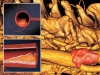 Atherosclerosis: A Tender Killer. From Theory to Practice Atherosclerosis: A Tender Killer. From Theory to Practice