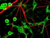 Тревожные расстройства у мышей помогут лечить нарушения психики у людей Тревожные расстройства у мышей помогут лечить нарушения психики у людей
