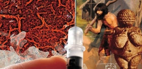 Diabetes – an evolutionary trap?