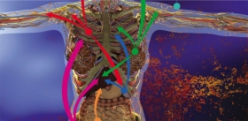 Ruled by the tumor: why are metastases so hard to suppress?