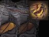 Смерть Прометея Смерть Прометея