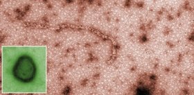 Вакцина от РСВ-инфекции